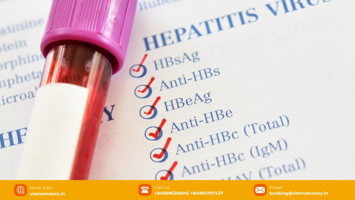 Hepatitis B, a viral liver infection transmitted through blood and bodily fluids, can cause chronic liver disease and liver cancer.